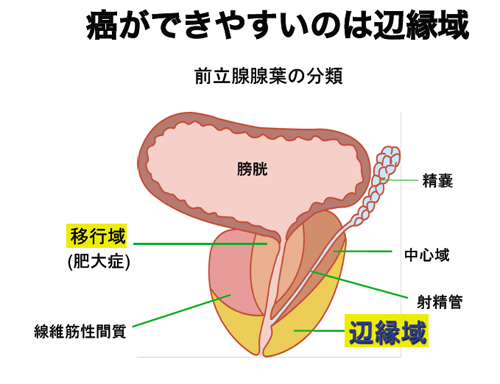 前立腺